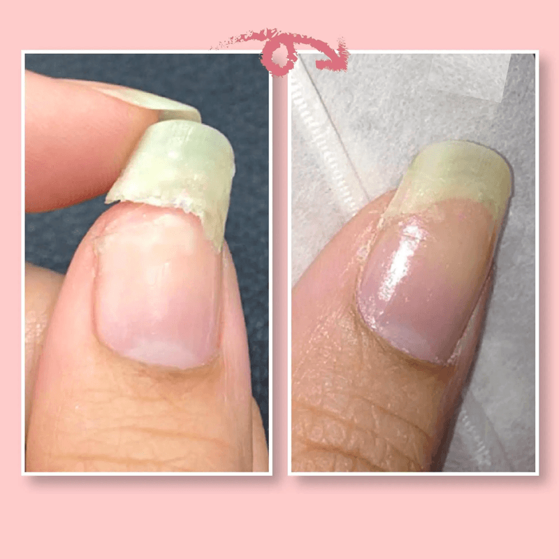 Nail Repair Protection Gel