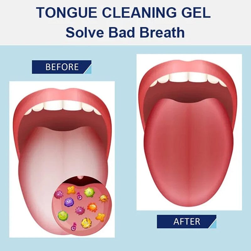 ✨Tongue Cleaning Gel Set👅