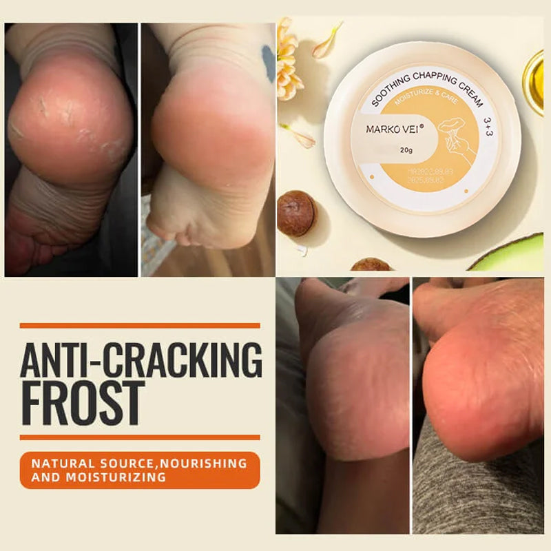 Winter Anti-Cracking Frost