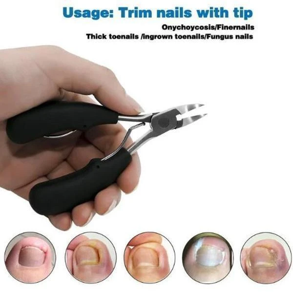 Medical-Grade Nail Clipper Set